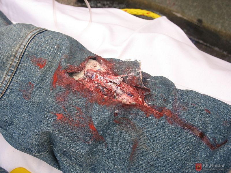 Bild 14 von 30 Realit&auml;tsnahe Wunde